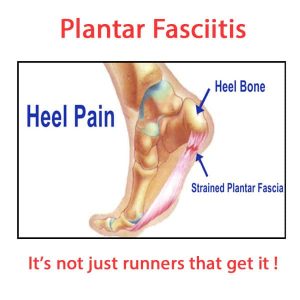 heel-pain